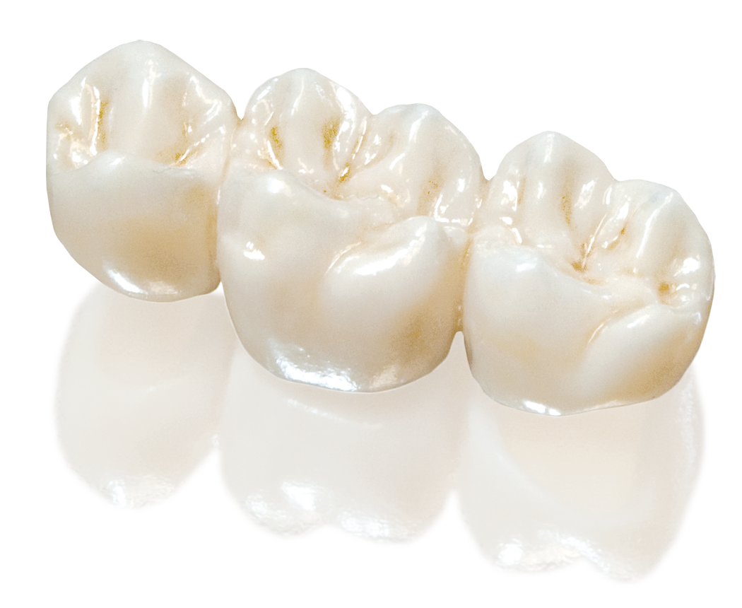 Установка постоянных зубных протезов 
