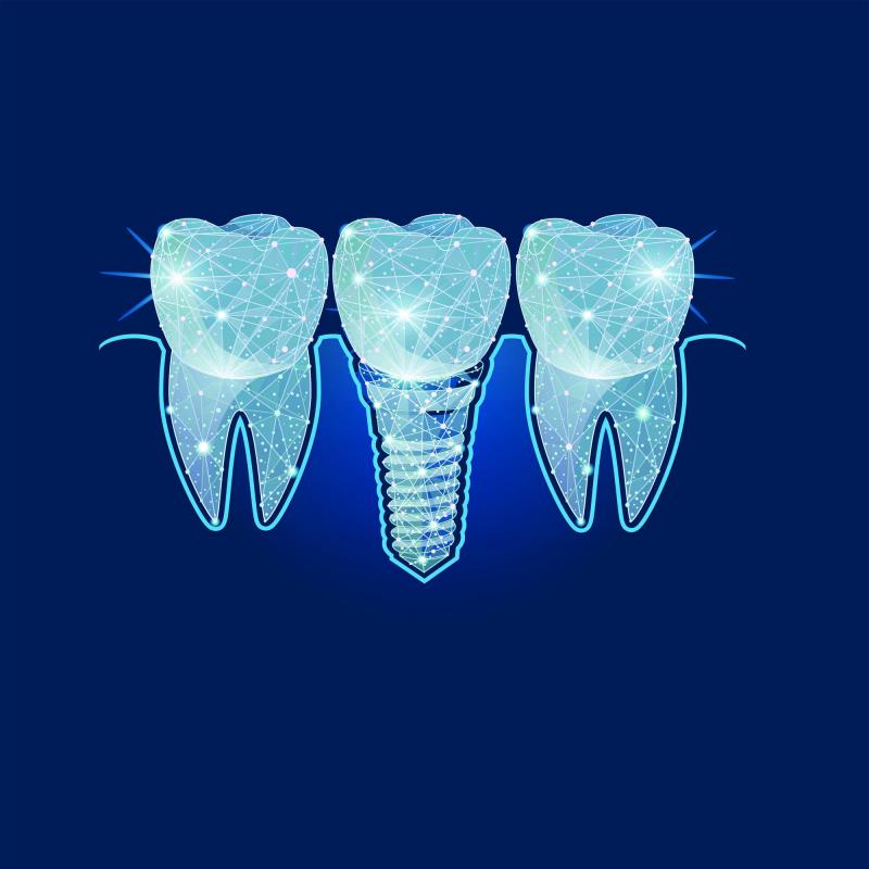 Специальное предложение «Готовый зуб»